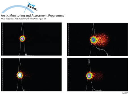 Representative comet images for a healthy donor, benzo[a]pyrene diol epoxide treated cells from a healthy donor, a participant with low DNA damage and a participant with some DNA damage (map/graphic/illustration)