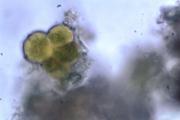 Pleurococcus_vulgaris_ 2.jpg